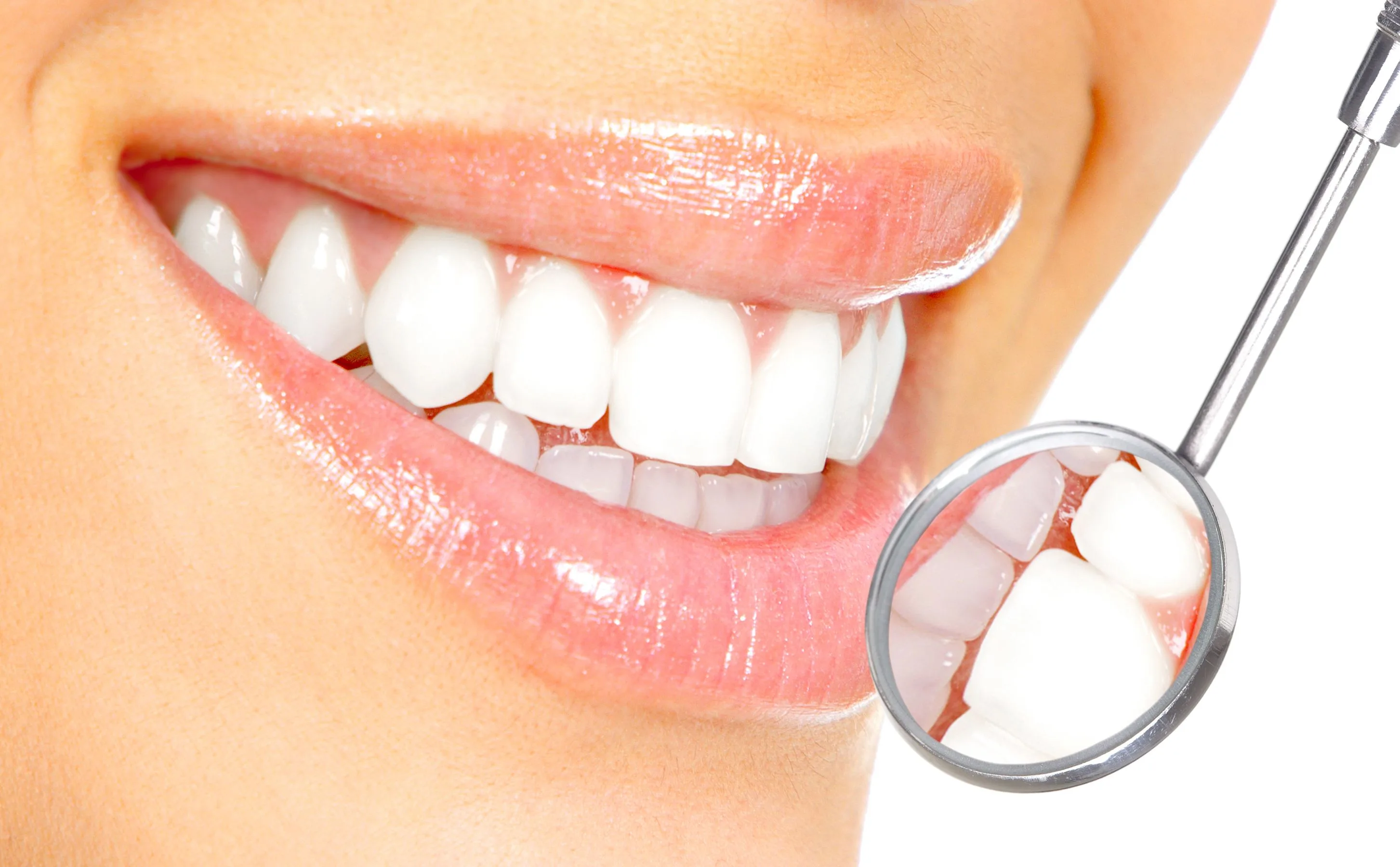 Close-up of bright white smile after professional teeth whitening at Krutav Patel DDS
